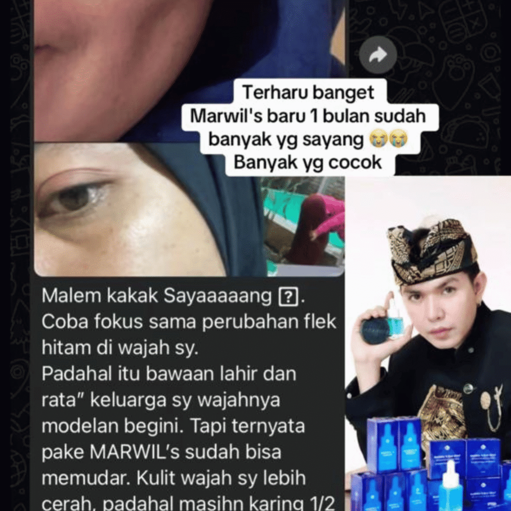 KERANJANG KUNING (22)